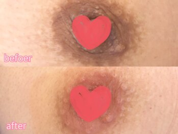 カシェット(cachette)/ローマピンク・ニップル