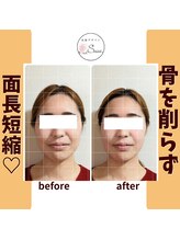 美顔デザインsuu.～若見えと歪み矯正専門の小顔サロン～/Before-After【30代】1回