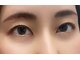 リトル アビー(Little Aby)の写真