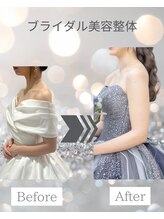 すみれ鍼灸整骨院/神戸　ブライダル美容整体
