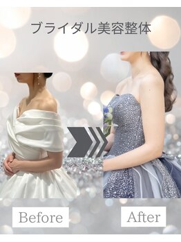 すみれ鍼灸整骨院/神戸　ブライダル美容整体