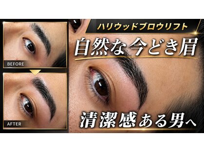 ル シャの写真