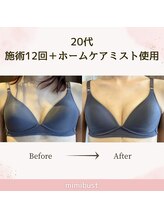 ミミバスト(mimibust)/バストアップBeforeAfter