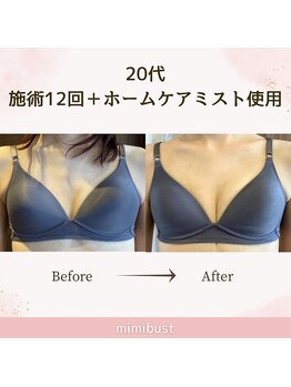 ミミバスト(mimibust)/バストアップBeforeAfter