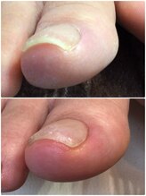 モアクリスタル(More Crystal)/