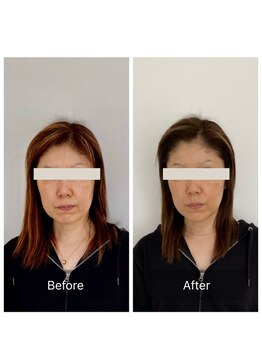 ハリラボ(hari Lab.)/【お客様の声】