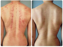 クラン シュプール 表参道店/【ハノンケア/首肩コリ解消】