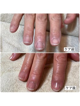 本格ネイルケア&トップコート