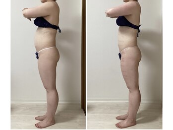 カリス/全身4回ビフォーアフター