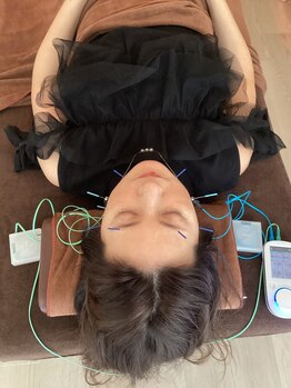 ハリファ鍼灸院 横浜関内院(HariFa鍼灸院)/美容鍼施術/美容鍼