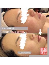 アンナカルナ(AnnaCarna)/お肌の様々なコンプレックスに