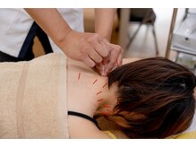 CA鍼灸整骨院の雰囲気（リラックスしてきたところで身体の調整を行い、スッキリさせます）