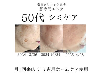 顔専門エステ 印西店の写真