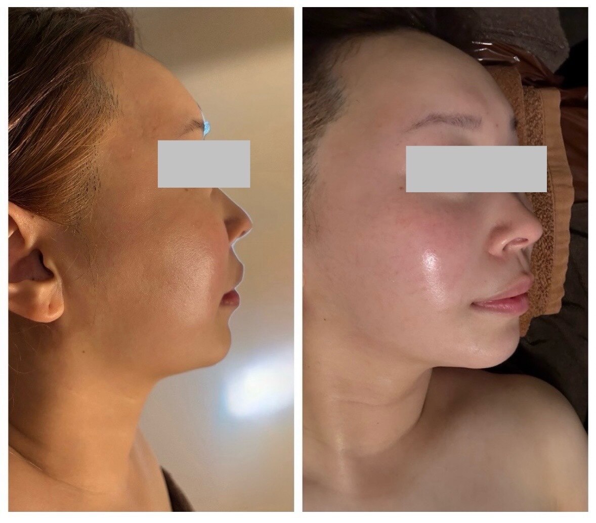 ニコ(NIKO)｜ホットペッパービューティー