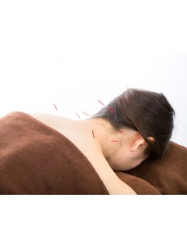 鍼灸施術を受けたい