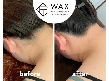 シエルエトワール 唐津店(Ciel Etoile)/匠道うなじワックス脱毛