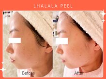 シロカネ イオンタウン西熊本店(SHIROKANE)/韓国肌管理ララピール☆