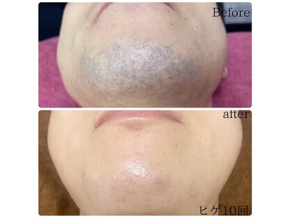 シャレールオム(Chareir Homme)の写真