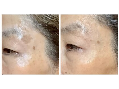 チェシル(CHESIL)の写真