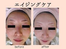 ウィズマツオカ 菊池本店/エイジング効果写真