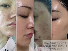 サロン ド エメ(salon de aimer)の雰囲気（長年の肌悩み、沢山の美容施術経験からお伝えできる事があります）