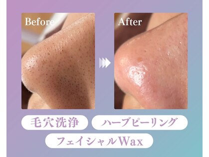 ミラ(Mira...)の写真