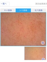 プリンセスフォー/シミ画像もしっかり見れる！