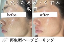 パールホワイトニングサロン 大船店