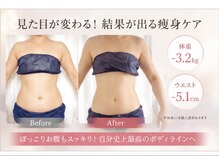トレゾール(tresor)