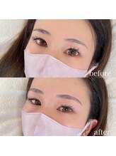 ダリ(Dali)/ハリウッドブロウリフト