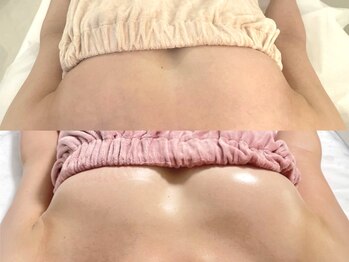 美人バスト 横浜店/バストアップ/育乳(10回施術)