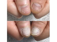 レジューネイル(Rejyu Nail)の雰囲気（深爪・噛み爪などお悩みのある方も3ヶ月で改善に導きます！）