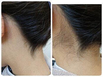 ヒスイ バイ アメイジング(Hisui by AMAZING)/【シェービング】うなじ