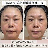 ハンナリ(Hannari)