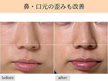 ペルク(perk)/小顔コルギ70分