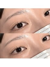 リグ(LIG)/上下マツパ