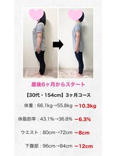 ベルソー鍼灸整体院(berceau鍼灸整体院)/30代女性ダイエットコース