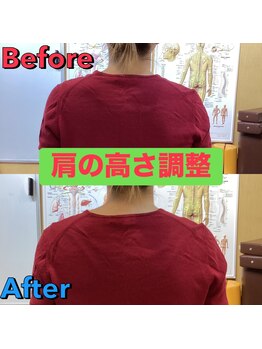 ヒデ整体院(Hide整体院)/猫背矯正骨盤矯正B/A肩こり腰痛