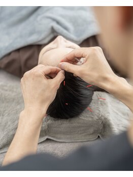 ニュート 表参道 外苑前(NUUT)/NUUT/美容鍼/小顔