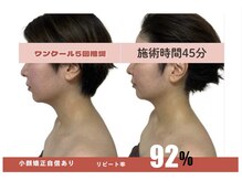 リノリー(rinory)