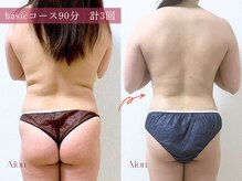 アイオン(Aion)/bacicコース90分　計3回での変化