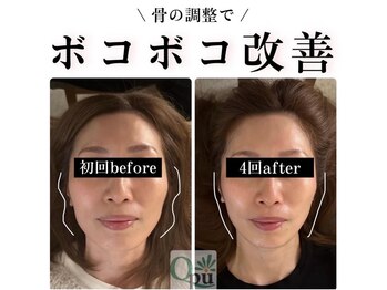 キュープ 大阪中百舌鳥店(Qpu)/シャープなお顔に!