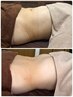 【むくみ/だるさ/肩こりに】腸もみ+背中リンパマッサージ・詳細はブログへ