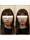 ロージースマイル(Rosy smile)の写真/骨から美容を叶える！顔悩みに速効性と持続力。筋肉刺激で脂肪燃焼！理想の小顔へ導きます♪