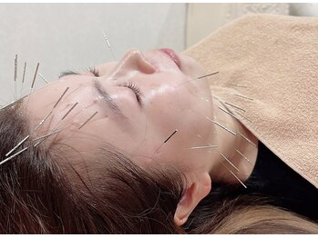 ナル ゆあん鍼灸接骨院(nalu)/電気を流す美容鍼