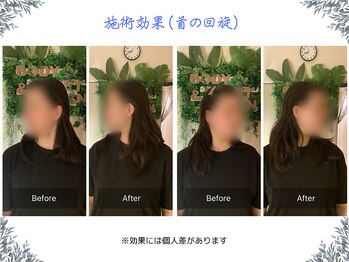 ボディ リセット アンド デザイン(Body Reset & Design)/【施術例】ビフォーアフター