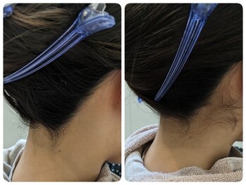 ヒスイ バイ アメイジング(Hisui by AMAZING)/【シェービング】うなじ