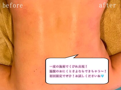 プラーナ(Pura-na)の写真