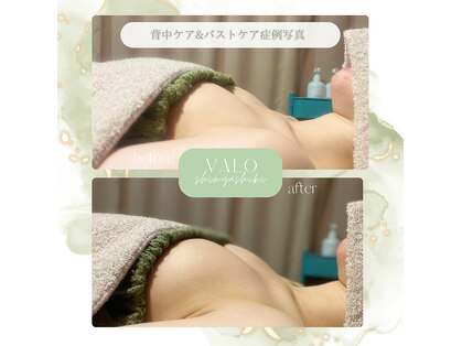 ヴァロ 熊本新屋敷(Valo)の写真