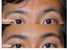 アルカナ(ARCANA)/HBL（ハリウッドブロウリフト）